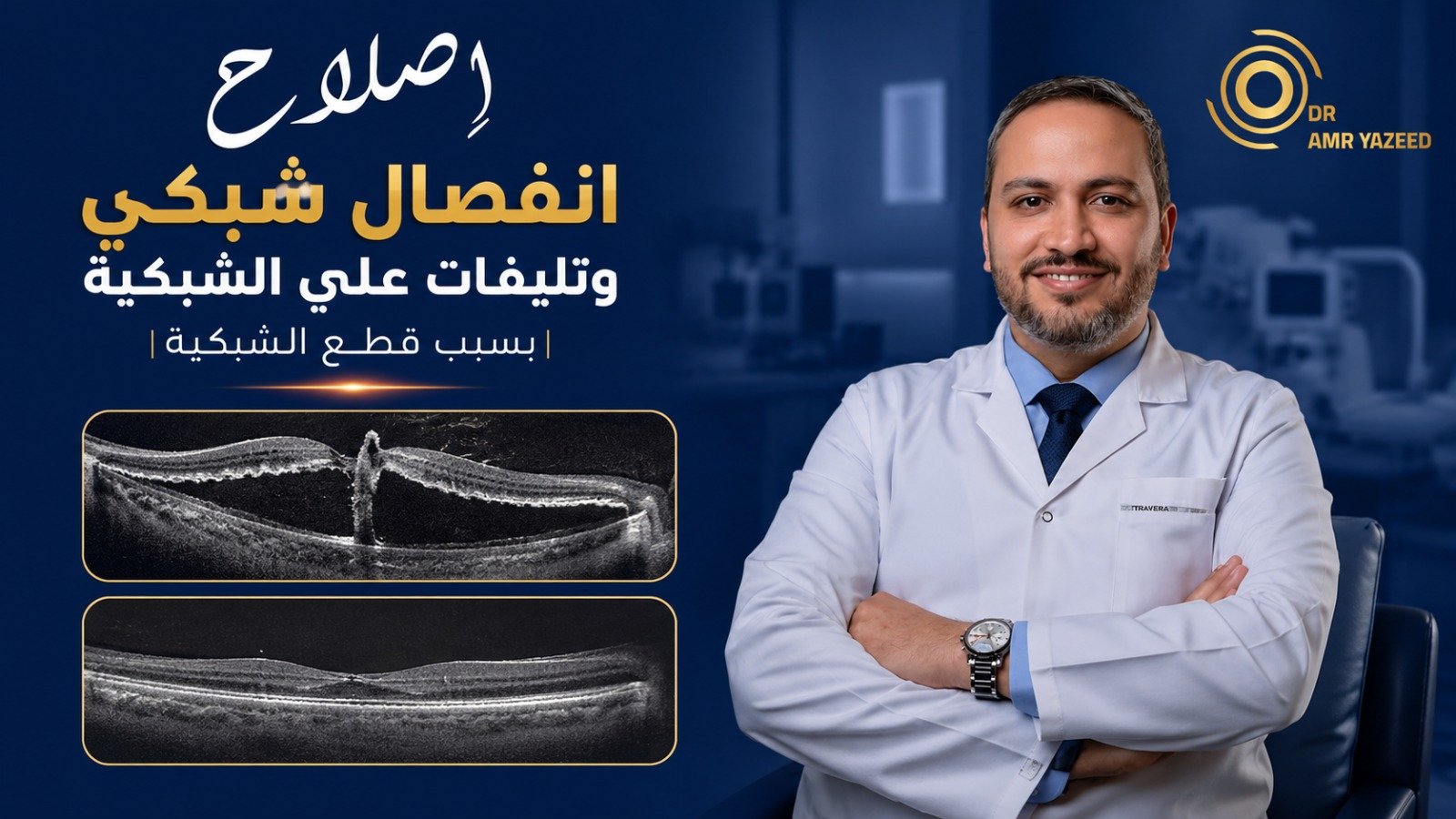 إصلاح انفصال الشبكية والتليفات الناتجة عن قطع الشبكية